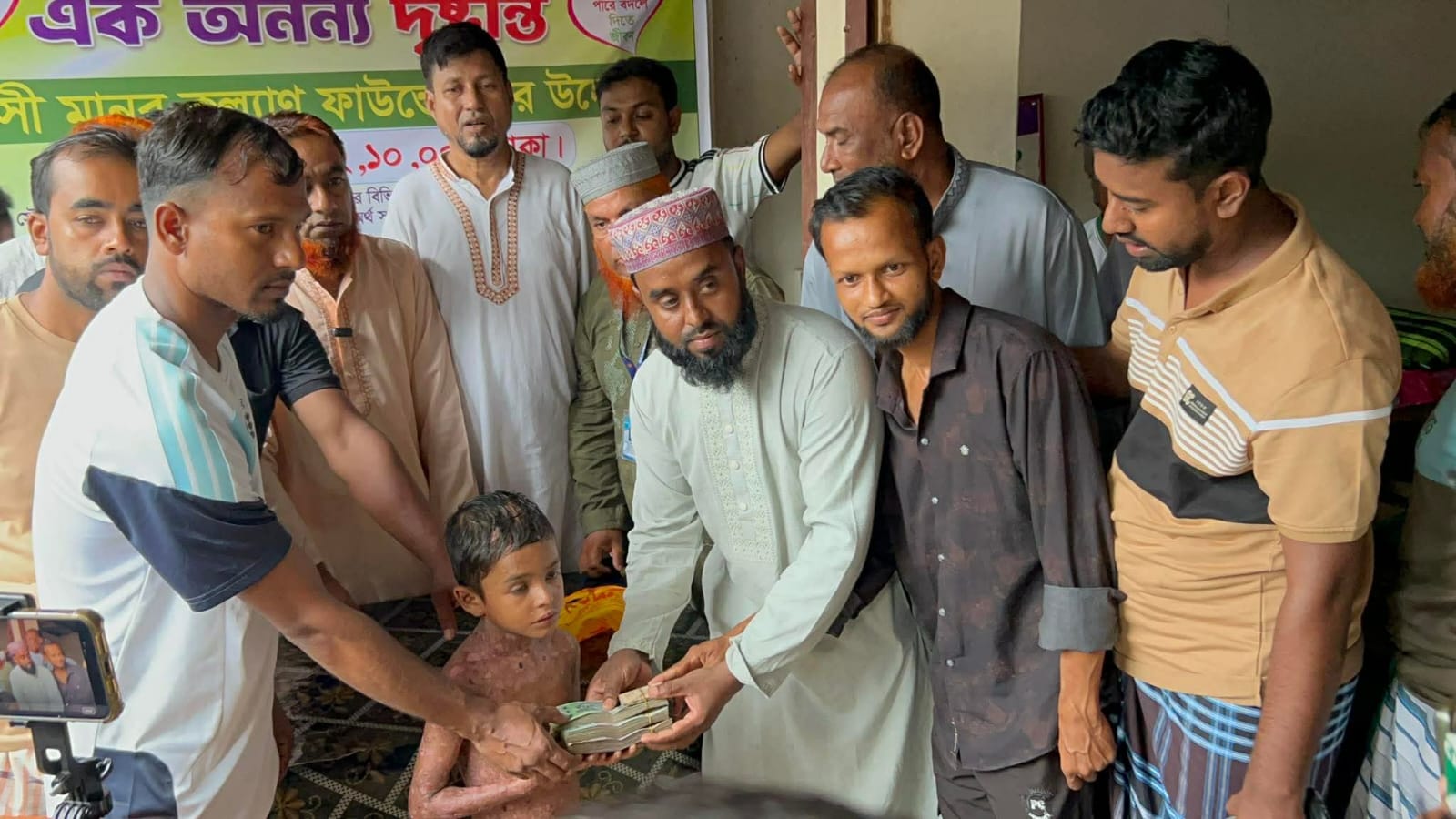 বিরল রোগে আক্রান্ত শিশুর চিকিৎসায় পাশে দাড়ালেন তারা